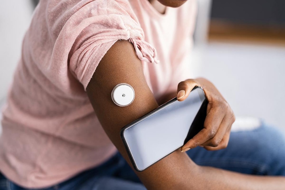 Los monitores de glucosa pueden ayudar quienes viven con diabetes tipo 2 que aún no necesitan insulina, según un estudio